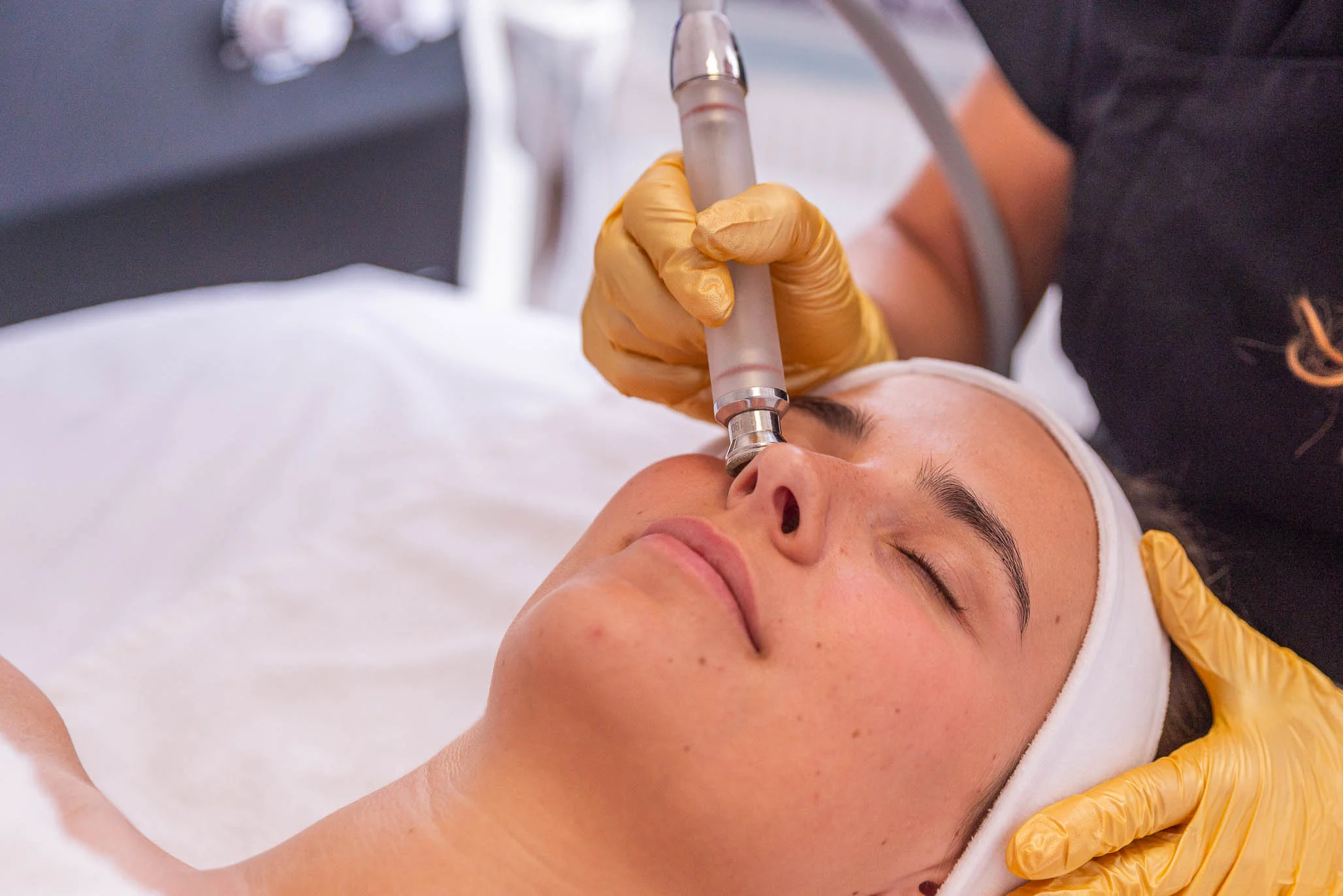 Diamantová dermabraze 1