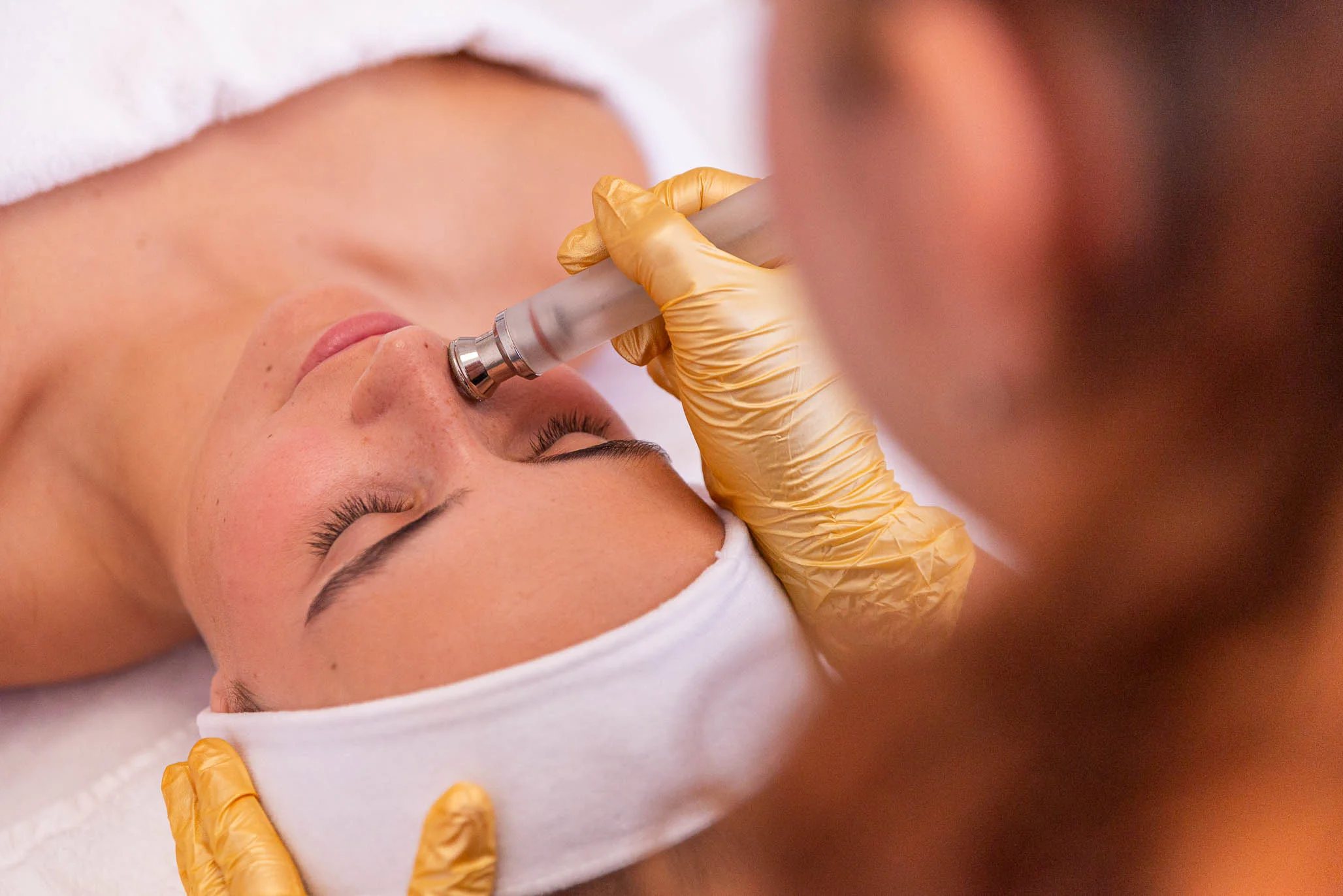 Diamantová dermabraze 3