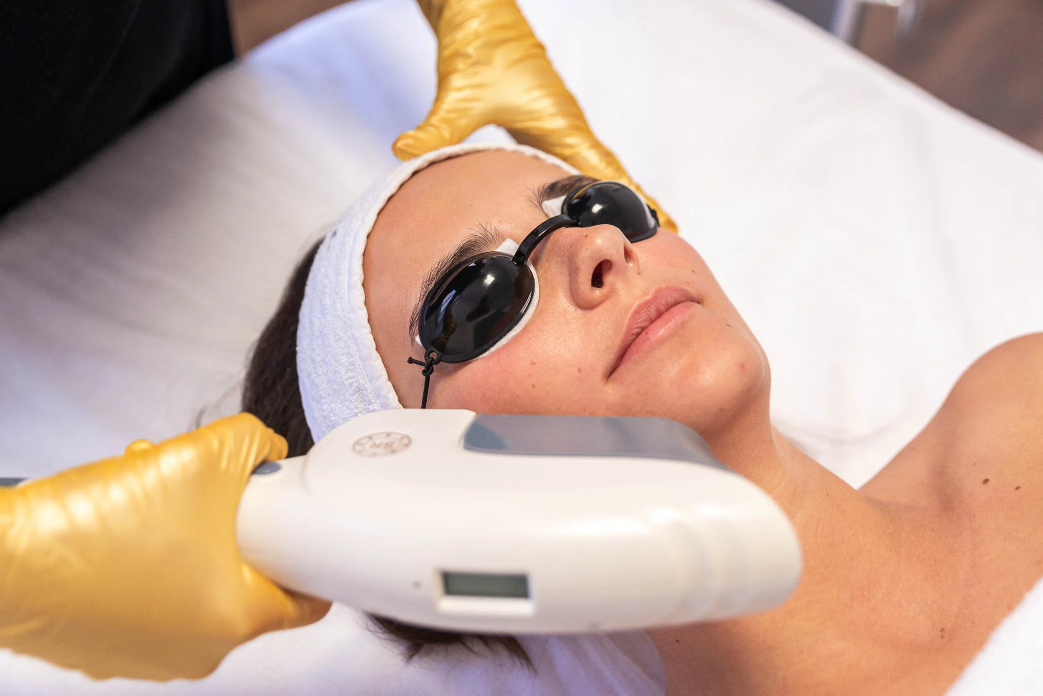 Intenzivní pulzní světlo 1